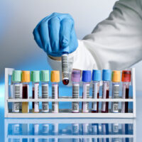 Blood Test Blood Test